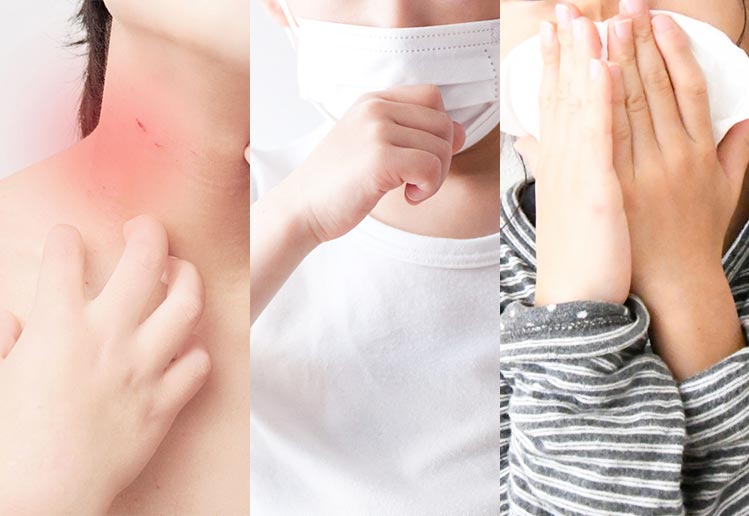 アトピー性皮膚炎とアレルギーマーチイメージ画像